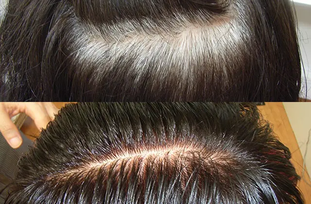 オーガニックハーブカラー ビフォーアフター